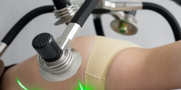 zabieg depilacji laserowej